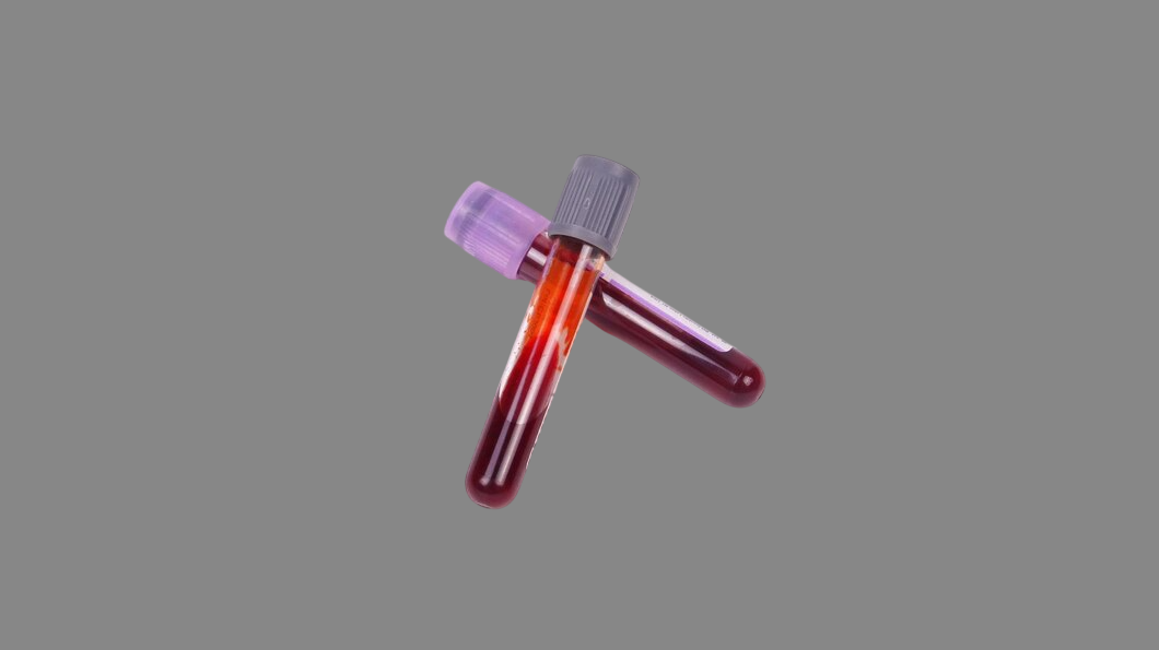 Freeze-dried plasma