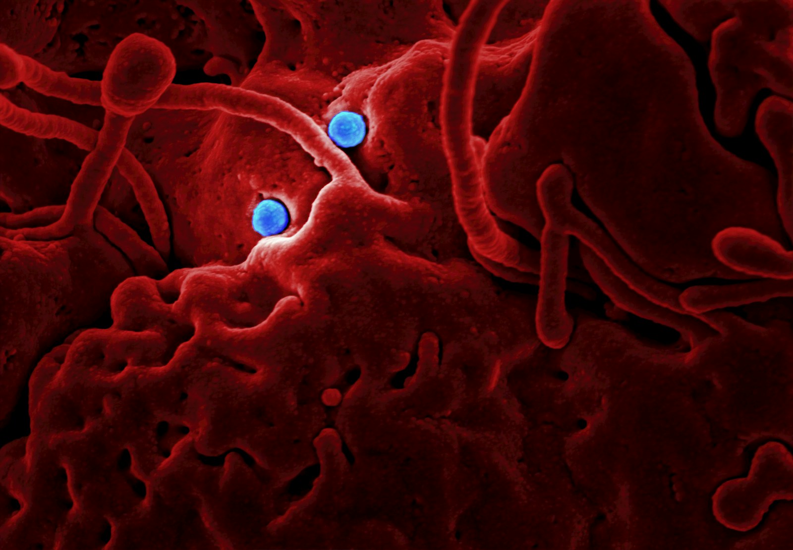Pilot lyophilizers for pharmaceutical development